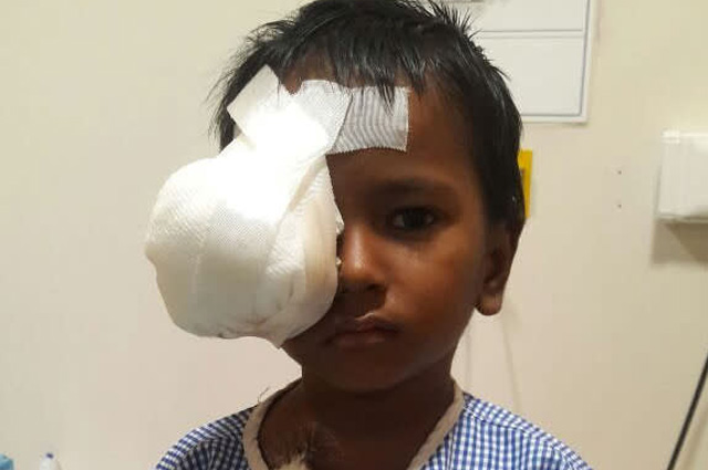 Help this 4 year old girl Puthul Kumari Paswanwho is the daughter of a farmer is now diagnosed with a severe eye cancer called Neuroblastoma in India. Your Donation will save this precoius life.